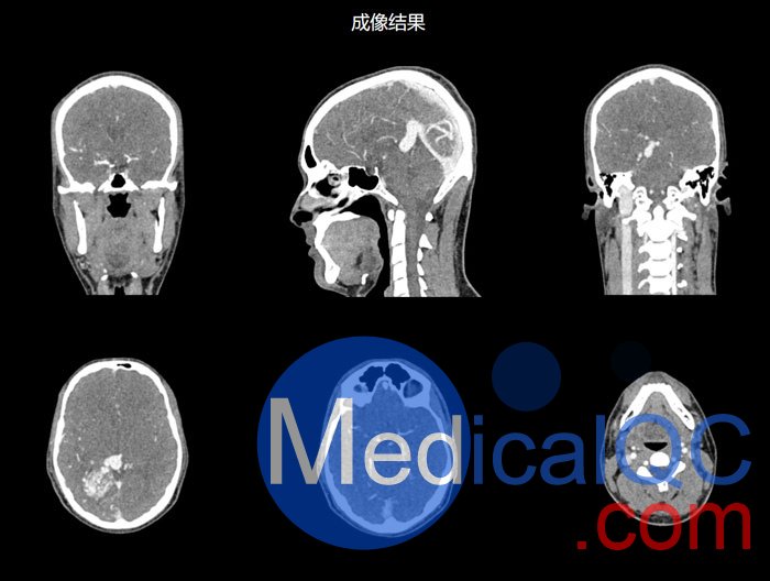 NLP1000頭頸模體，NLP1000頭部模體，NLP1000頭模