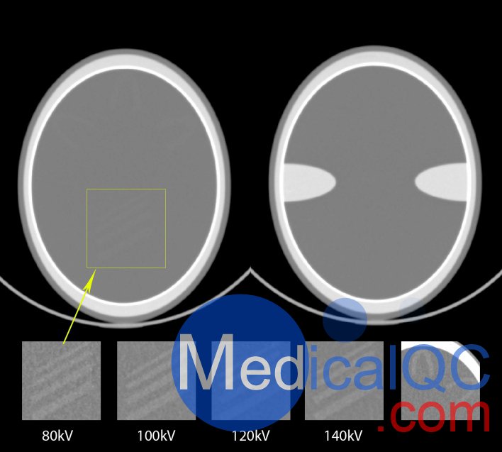 QRM-Cranial-CT-Phantom，顱腦CT模型，Cranial CT Phantom