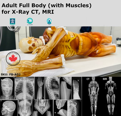 FB-A02成人全身模體,FB-A02全身CT模型，適用于X射線，CT,MRI